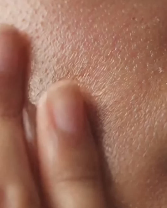 The Barrier Reset Kit